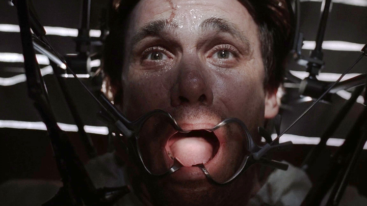 《X档案》男子被外星人绑架做实验，牙齿被钻孔，体内被植入金属片