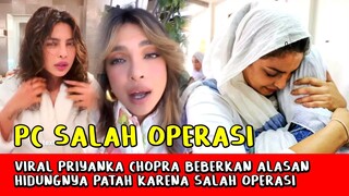 Heboh! Hidung Priyanka Chopra Patah, Begini Klarifikasi Sang Aktor!