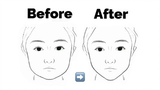 เหมาะสำหรับใบหน้ากลม｜ความรู้สึกแข็งแรงของร่างกาย｜ใบหน้าล่างแคบ+ขากรรไกร+คาง+ฟัน การปรับเปลี่ยนทางกาย