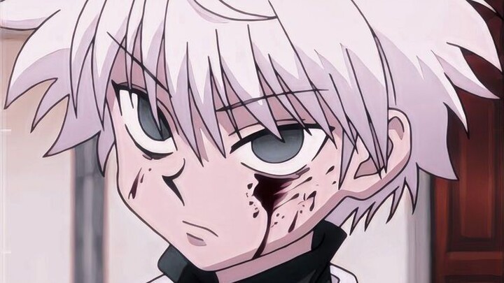 Killua Zolodyck (Hunter x hunter). ib: pinterest. Dilarang repost ya kawnd😵. tahap belajar juga:>