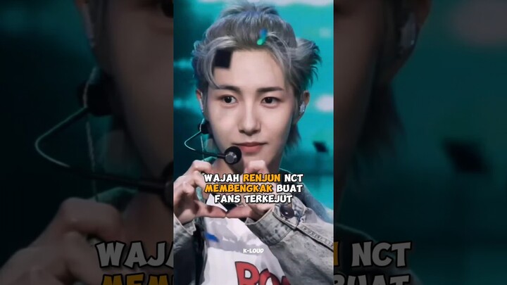 Wajah #renjun #nct #nctdream membengkak buat fans terkejut #shorts #kpop #viral