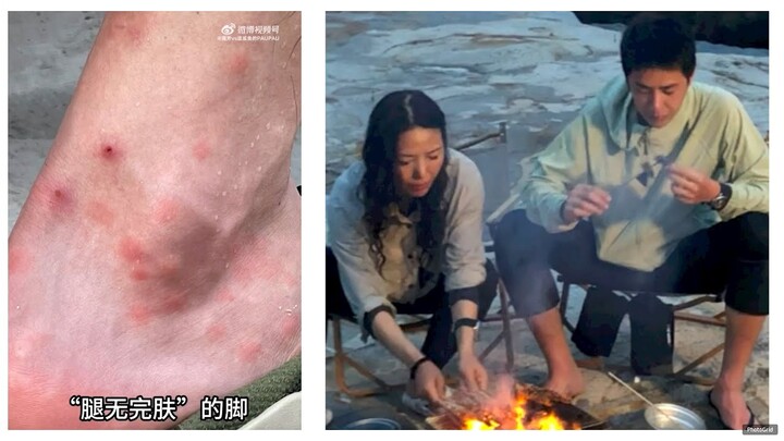 Fans were heartbroken to see Wang Yibo's feet and ankles covered in mosquito and leech bites.