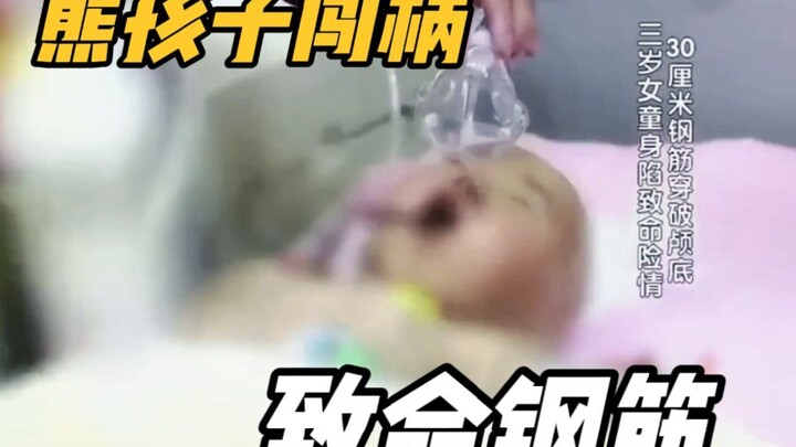 3岁女童路边等妈妈，却被路过的熊孩子重伤，30厘米钢筋贯穿头部