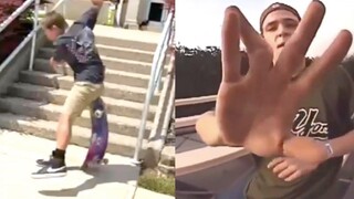 การรวบรวม Slams Skateboarding ที่โหดร้าย (Skateboarding Fails Skateboarding Compilation)