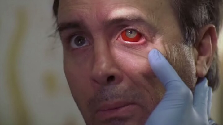 [Old Pao] Một người đàn ông có đôi mắt đỏ ngầu và cơ thể đầy vết bầm tím. Bác sĩ bất lực nhưng ông đ