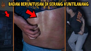 🔴 508- BADAN MERAH GATAL DI SERANG KUNTILANAK