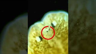 This microscopic worm has two heads and three eyes!