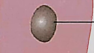 Animal Cells vs Plant Cells