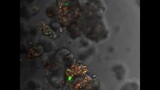 Patient-derived prostate cancer cells growing in 3D - Prostate Cancer Research Group