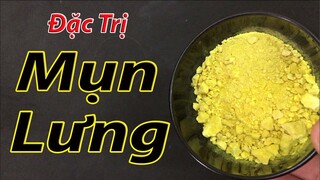 Bật mí 2 cách trị mụn lưng tại nhà bằng tinh bột nghệ, hiệu quả trên cả tuyệt vời