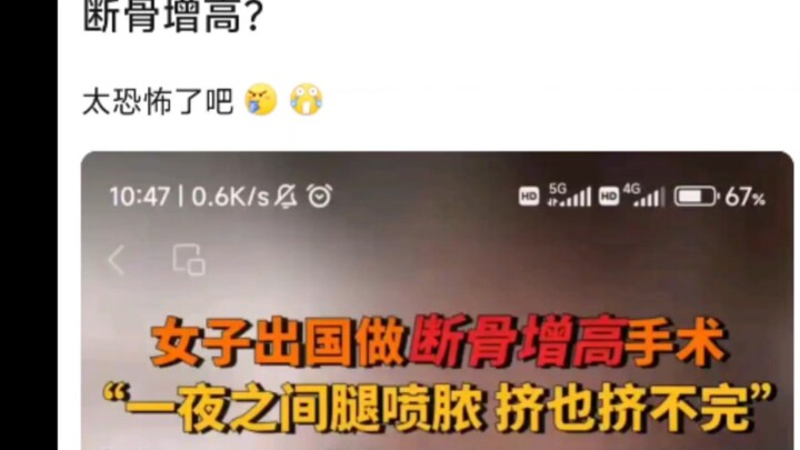 断骨增高？以为只是玩笑，没想到真有人实践了