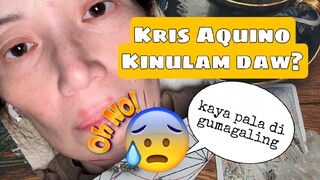 Kris Aquino Kinulam daw