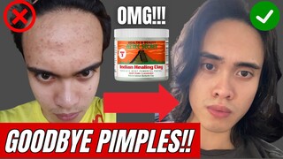 Aztec Secret Indian Healing Clay REVIEW | Paano Gamitin | Paano Patuyuin Ang Tigyawat