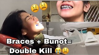 I Got Braces? + Vlog | Jamaica Galang