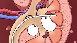 Laparoscopic renal cyst surgery