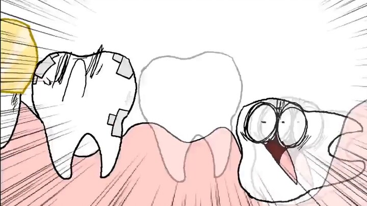 【Comic Master】Bad Teeth Animation (2)