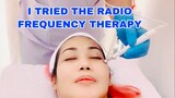 TRIED THE RADIO FREQUENCY THERAPY TO REDUCE EYEBAGS