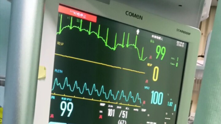 当你在心电监护仪前憋气时......