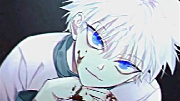 ♡Killua♡