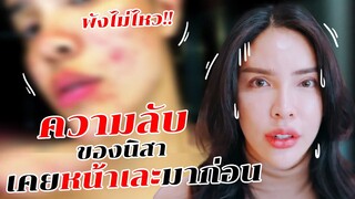 ความลับของนิสา เคยหน้าเละมาก่อน!!! | Nisamanee.Nutt