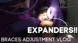 BRACES ADJUSTMENT!! + Getting Expanders | Lady Pipay