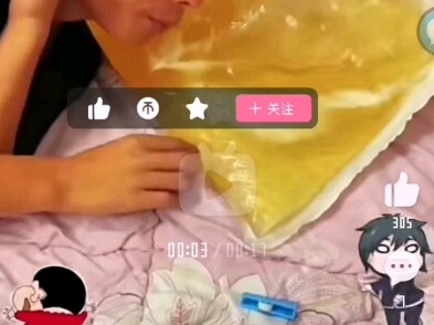 神经