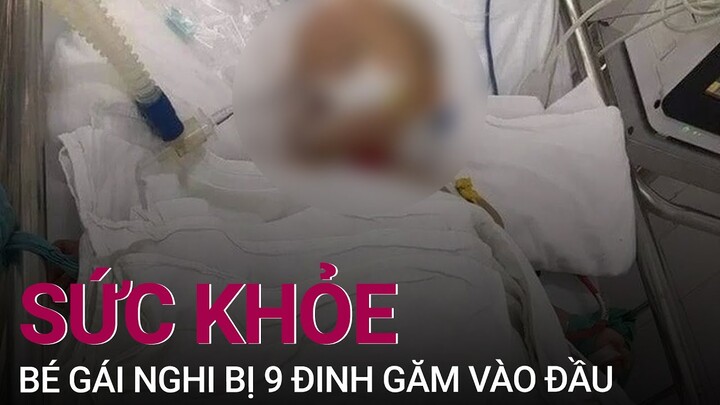 Cập nhật sức khỏe bé gái nghi bị 9 đinh găm vào đầu | VTC Now