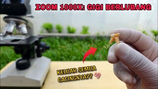 ZOOM 1000X: GIGI BERLUBANG