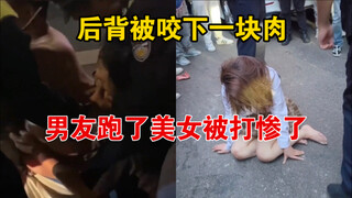 女子路怒与情侣发生冲突，男子为保护女友后背被咬下一块肉，知情人：男子后续已去医院打破伤风