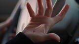 Nữ chính phim "X-Files" vô tình bị gai đâm xuyên, bất ngờ đưa tay ra khỏi vết thương