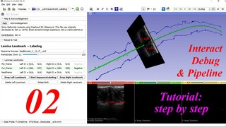 Python Interact, PyCharm Debug & 3D Slicer Pipeline -- 3D Slicer Extension Development Tutorial #02