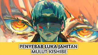 Penyebab Luka Jahitan Di Mulut Kishibe, chainsaw man