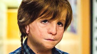 Abnormal Boy Proves The Real Definition Of "Don't Judge Book By Its Cover"