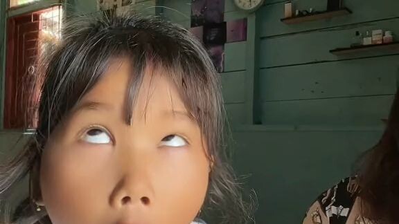 yang like semoga jerawatnya hilang yang nggak like semoga paling parah jerawat nya