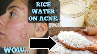 I Tested Rice Water for 1 Week Straight || SHOCKED BY THE RESULTS... THIS IS HOW MY SKIN LOOKS NOW..