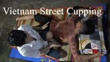 ASMR - $5 - Vietnam Street Cupping Massage
