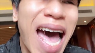 Có chuyện gì thế? Thật là điên rồ
