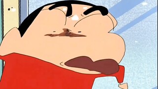 Crayon Shin-chan丨Phong cách trừu tượng Aoi thực sự rất dễ thương