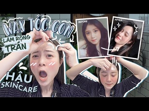 Vlog#100 WAX TÓC CON- LÀM RỘNG TRÁN KHÔNG CẦN PHẪU THUẬT