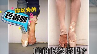 Ballet bác bỏ tin đồn giày pointe không tốt cho chân