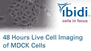 48h Phase Contrast Live Cell Imaging of Epithelial MDCK cells