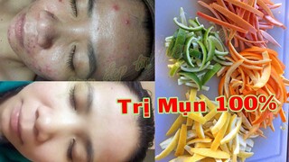 Acne Removal | Mặt Mụn Nhiều Đến Đâu Cũng Khỏi Nhờ Phương Pháp Này  | Làm Đẹp Từ Thiên Nhiên #11