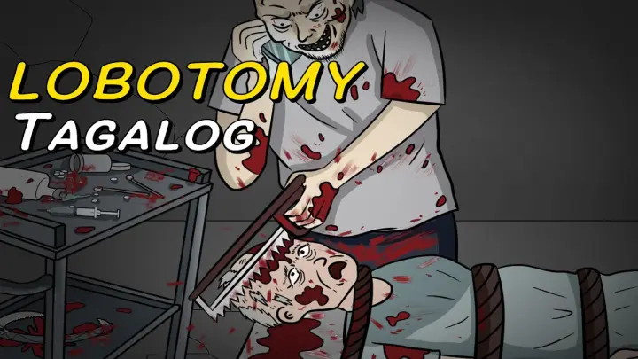 LOBOTOMY | TAGALOG ANIMATED HORROR STORIES