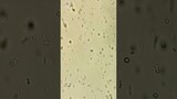 Kefir Under Microscope (Probiotic Drink)