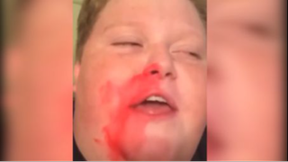 Tôi đau quá bro #memehay