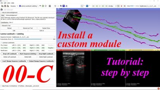 How to install a custom extension module- #00-C. 3D Slicer Tutorial step by step