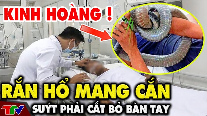 Rắn hổ mang cắn, người đàn ông ở Quảng Bình suýt phải cắt bỏ bàn tay |🔥 TIN AN NINH CỰC NÓNG
