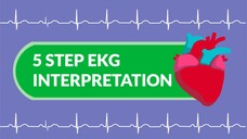 5-step EKG Interpretation