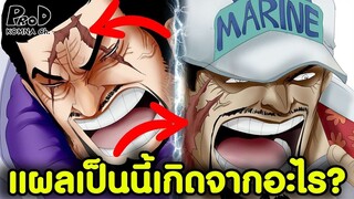 วันพีซ - แผลเป็นและสาเหตุที่มาของแผล [KOMNA CHANNEL]