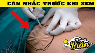 Ớn Lạnh với 5 loài động vật chui vào cơ thể con người